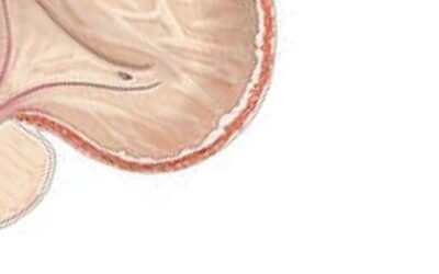 Blog de salud 2 Ácido úrico alto: tu ayuda natural para regularlo