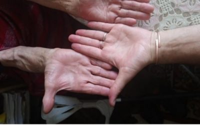 Blog de salud 18 Remedios naturales para tu piel