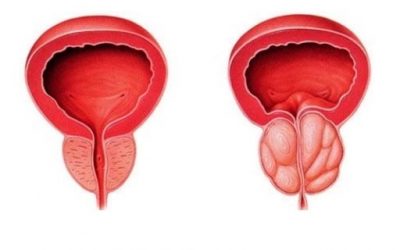 Blog de salud 5 La próstata