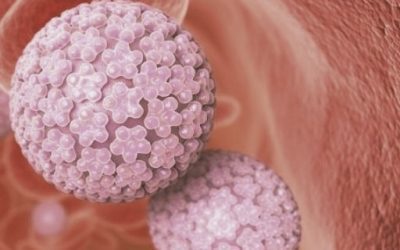 Blog de salud 18 Papiloma humano: Remedios naturales que te ayudan