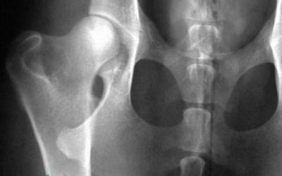 Blog de salud 16 Dolores articulares