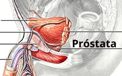 Blog de salud 14 Próstata grande