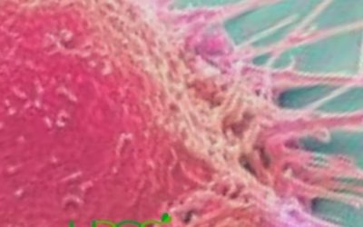 Blog de salud 4 ¿Qué es el cáncer? Descubre más sobre el cáncer