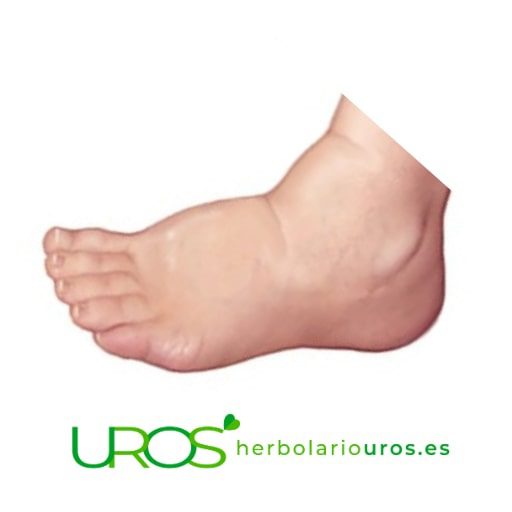 Remedio natural para la inflamación Descubre los remedios naturales con propiedades antiinflamatorias Suplementos naturales que te ayudan en casos de inflamación e hichazon - los suplementos con propiedades antiinflamatorios