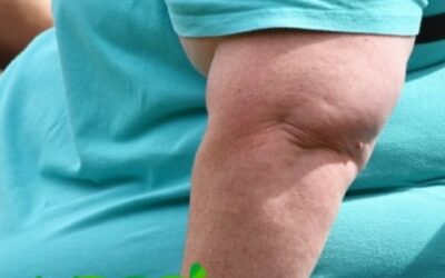 Las mejores pastillas para adelgazar: Adelgaza naturalmente