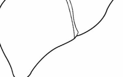 ¿Cómo limpiar el hígado naturalmente? Descúbrelo